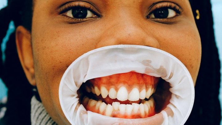 Hvorfor tandlægeundersøgelser er vigtige for dit generelle helbred
